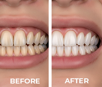 before_after_patient_1