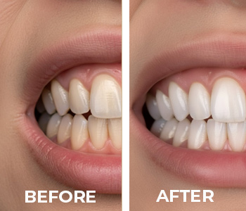 before_after_patient_2