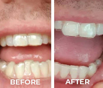 before_after_patient_3